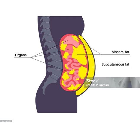 Ilustración de la grasa visceral acumulada alrededor de los órganos internos, destacando su peligro para la salud.