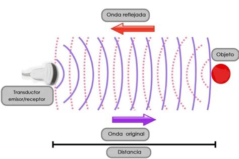 Representación gráfica de cómo las ondas de ultrasonido rompen las células de grasa.