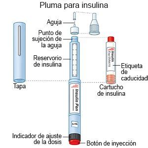 Ilustración de los diferentes métodos de administración de insulina: jeringa, pluma y bomba.