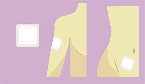 Infografía detallando la estructura de un parche anticelulítico y su mecanismo de acción