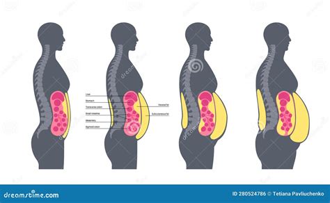 diagrama explicando cómo el alcohol contribuye a la grasa abdominal
