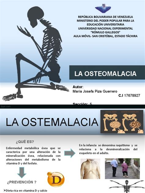 Infografía detallando las diversas causas de la osteomalacia, desde la dieta hasta factores genéticos y medicamentos.