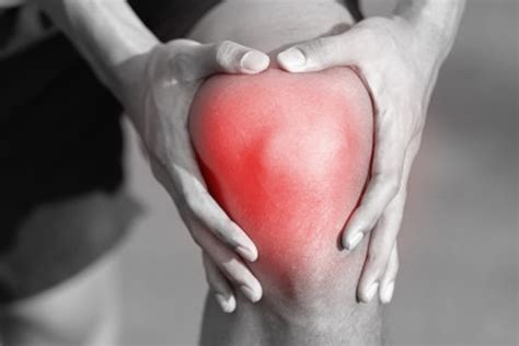 Imagen de una rodilla hinchada y con signos de inflamación.