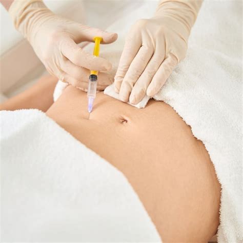 diagrama del procedimiento de hidrolipoclasia, mostrando la infiltración de solución, la acción de los ultrasonidos y la eliminación de grasa.