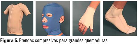 Imagen de paciente usando ropa de compresión postoperatoria