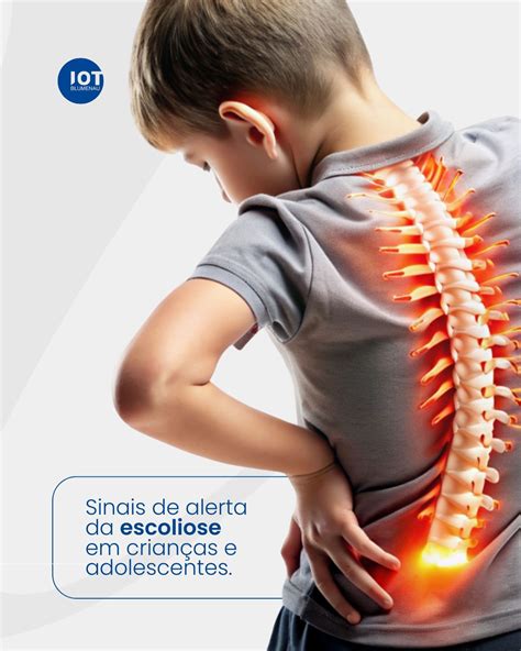 Pessoa com ombros desalinhados e curvatura visível da coluna