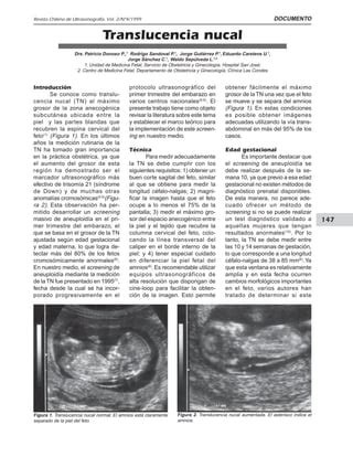 Diagrama de la medición de la translucencia nucal (TN) en un feto durante la ecografía del primer trimestre.