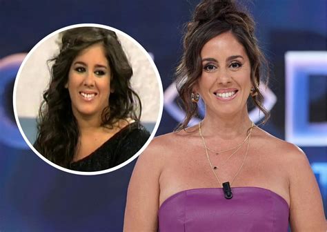 Anabel Pantoja antes y después de la banda gástrica, mostrando la transformación física.