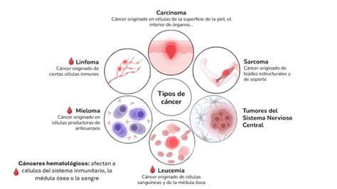 infografía sobre tipos de cáncer y su relación con la pérdida de peso