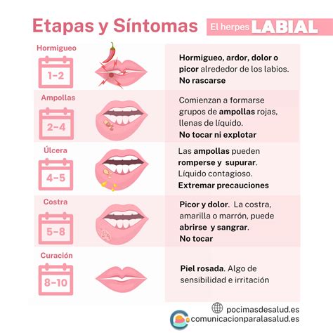 Ilustración comparativa de diferentes tipos de lesiones labiales: herpes, afta, mucocele, mancha de Fordyce.