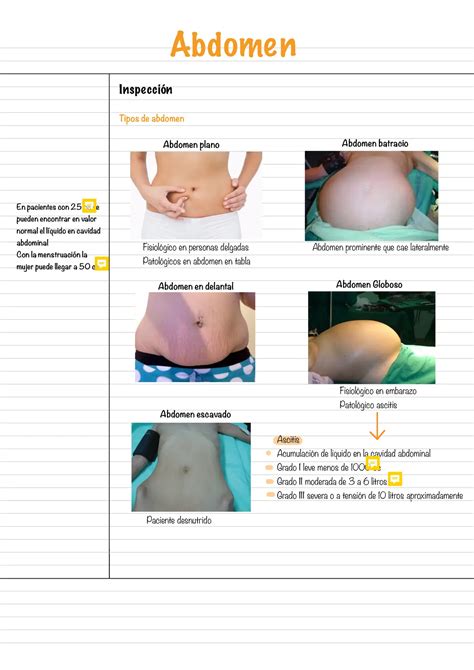 Fotografía preoperatoria de paciente con abdomen globoso y acúmulo de grasa en flancos.
