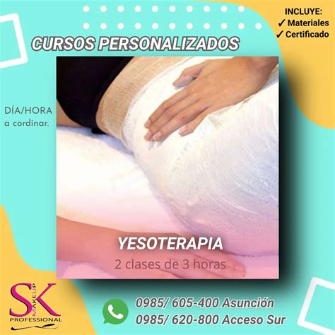 infografía detallando el proceso de la yesoterapia, desde la aplicación de las vendas hasta la retirada.