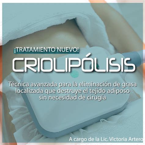 ilustración mostrando las diferentes áreas del cuerpo donde se puede aplicar la yesoterapia (abdomen, muslos, brazos).