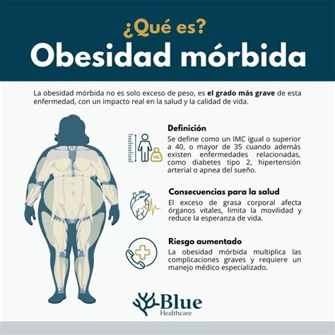 fotografía de Michelle antes de su transformación, mostrando las dificultades asociadas a la obesidad mórbida
