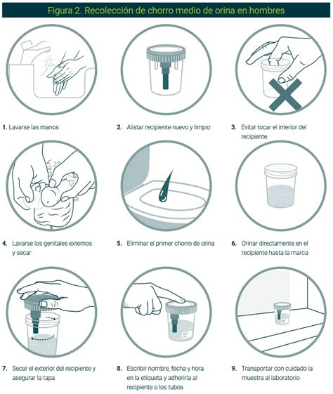 Ilustración del procedimiento de recolección de muestra de orina para análisis.