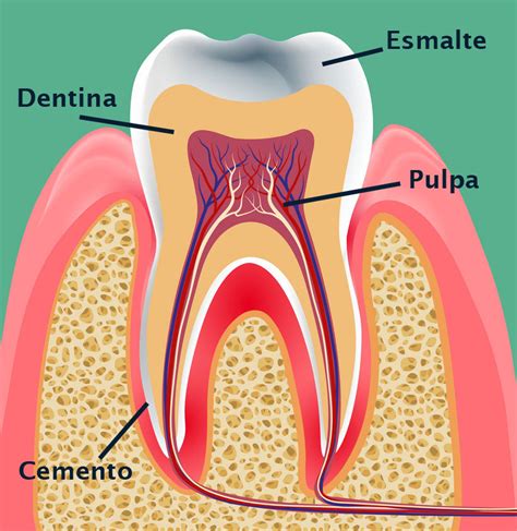 Ilustración mostrando las diferentes capas del diente (esmalte, dentina) y cómo el desgaste las afecta.