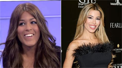 Infografía comparativa de antes y después de retoques estéticos de Violeta Mangriñán