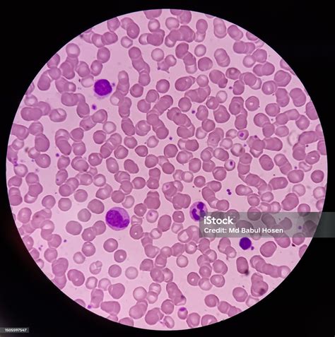 Microfotografía de células inmunitarias (leucocitos) mostrando su migración.