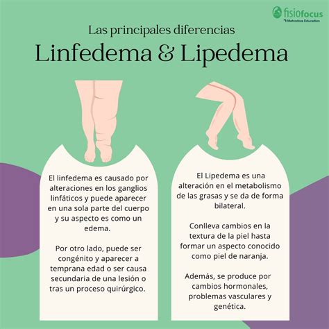 Infografía mostrando la diferencia entre lipedema (acumulación simétrica de grasa en piernas) y linfedema (hinchazón unilateral por acumulación de linfa).