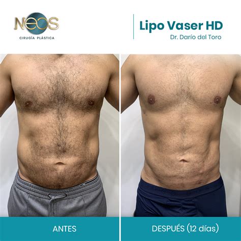 Comparativa visual del 