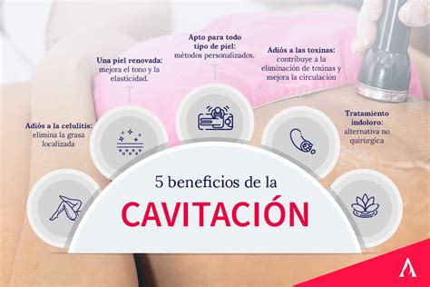 Infografía sobre los riesgos y beneficios de la cavitación estética