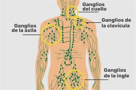 Ilustración del recorrido de los canales linfáticos y ganglios