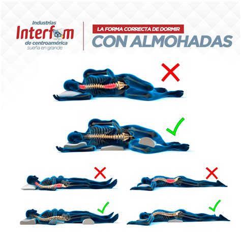 ilustración mostrando cómo colocar una almohada debajo de las rodillas y otra bajo las caderas para dormir boca abajo de forma más saludable