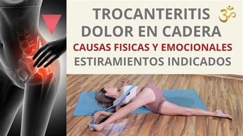 Ilustración mostrando los puntos de dolor típicos en la trocanteritis y la irradiación del mismo.