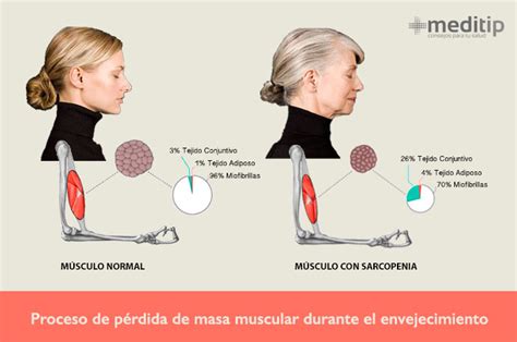 gráfico que muestra la disminución de la masa muscular y el aumento de la grasa corporal con la edad