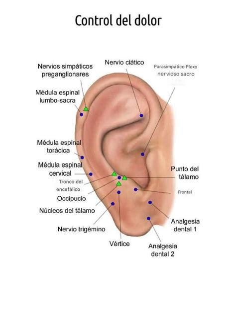 Infografía mostrando puntos de acupresión en la oreja relacionados con la reducción del apetito.