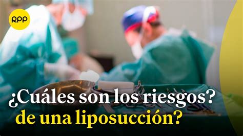 infografía sobre el procedimiento de liposucción