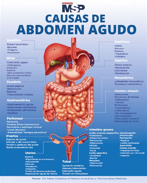 Infografía detallando las causas comunes de dolor abdominal nocturno, con iconos representativos para cada condición.