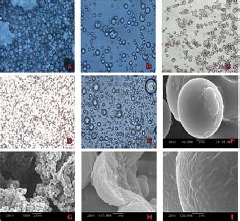 Microfotografía de las microesferas de ácido úrico excretadas por reptiles, mostrando su estructura organizada.