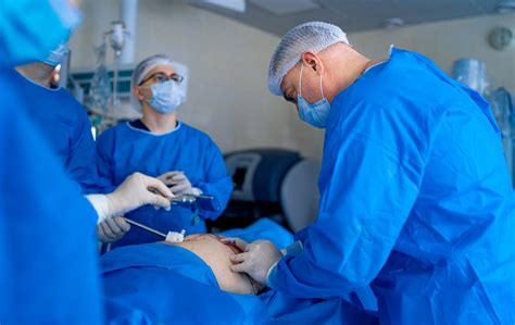 Esquema de la cánula de liposucción WAL con chorro de agua y aspiración