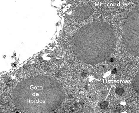Micrografía electrónica de un lisosoma, mostrando su estructura membranosa y contenido granular.