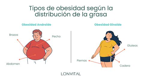 ilustraciones de los tipos de obesidad: periférica y central (abdominal)