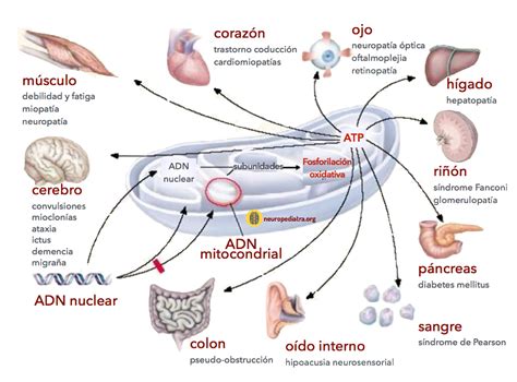 Infografía detallando las alteraciones mitocondriales, la disfunción del calcio y la producción de especies reactivas de oxígeno (ROS) en neuronas de pacientes con Alzheimer.