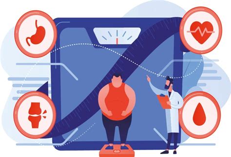 Gráfico comparativo de la relación entre obesidad, diabetes y actividad física