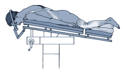 Ilustración de la posición Concorde mostrando la elevación del tronco