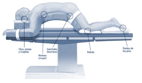 Fotografía del accesorio Wilson Frame en uso para la posición de laminectomía