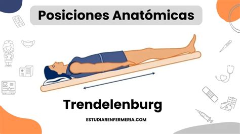 Representación gráfica de la posición Anti-Trendelenburg