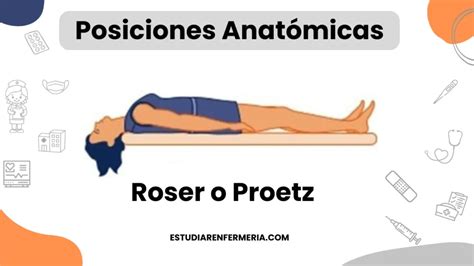 Esquema que muestra la posición Proetz con hiperextensión cervical