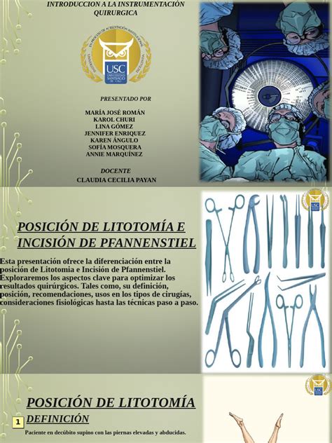 Ilustración de la posición de Litotomía con perneras