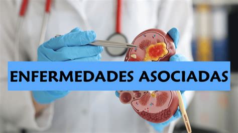 Infografía sobre las enfermedades asociadas a disfunciones de la calmodulina