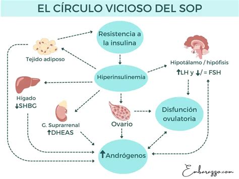 Diagrama que ilustra los cuatro factores clave del SOP que dificultan la pérdida de peso: resistencia a la insulina, exceso de andrógenos, inflamación y metabolismo lento.