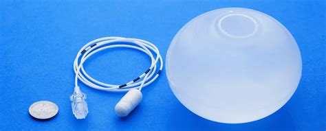 Esquema del funcionamiento combinado de Ozempic y Balón Gástrico Allurion