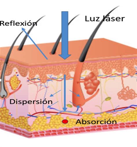 Diagrama explicativo del funcionamiento del lipoláser, mostrando la penetración del láser en la piel y su efecto en las células de grasa.