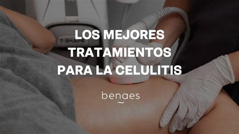 Infografía comparativa de diferentes tratamientos estéticos para la celulitis y flacidez en brazos, mostrando su mecanismo de acción y efectividad.