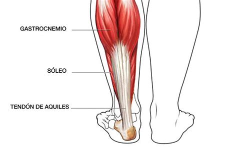 Esquema anatómico de los músculos de la pantorrilla, destacando el gastrocnemio y el sóleo.